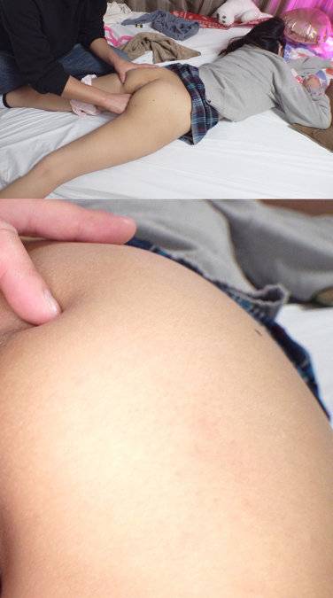  BSKC-034